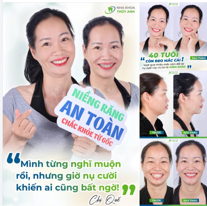 DÙ LÀ BAO NHIÊU TUỔI VẪN KỊP ĐỂ NỞ NỤ CƯỜI XỨNG ĐÁNG