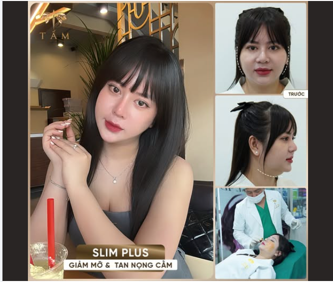 Mỡ má nọng cằm – ‘khắc tinh’ của mọi cô gái. Vậy đâu là bí kíp để khắc phục nhanh chóng?