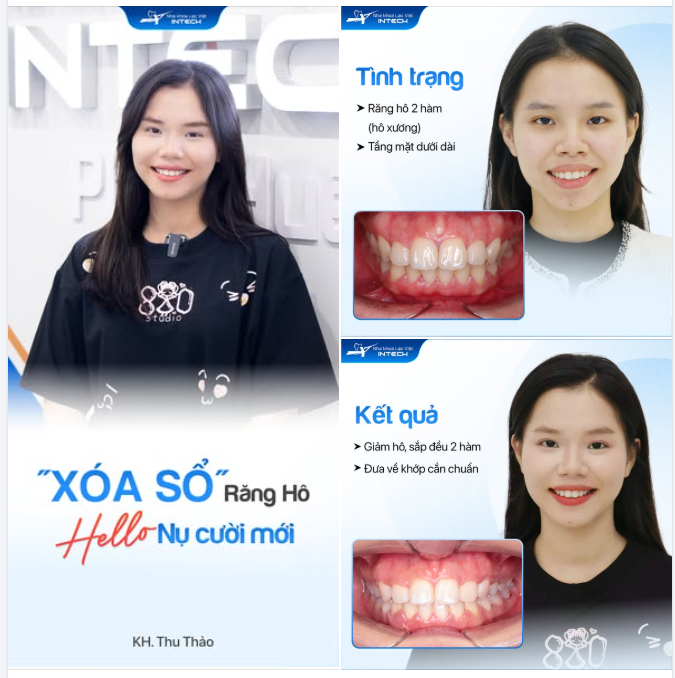 "THOÁT" HÔ HÀM - LÊN ĐỜI NỤ CƯỜI XINHHH