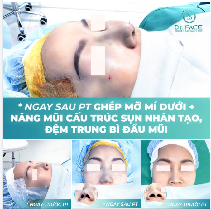 SOI GƯƠNG “MÊ” MŨI NGAY, CHO LIỀN DR.FACE 5