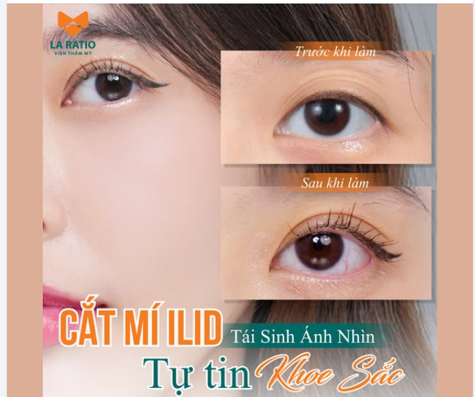 “Mách” các nàng U40 U50 bí kíp TRẺ HƠN 5 tuổi chỉ với 40 phút.
