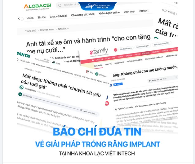 BÁO CHÍ ĐƯA TIN VỀ GIẢI PHÁP TRỒNG RĂNG IMPLANT TẠI NHA KHOA LẠC VIỆT INTECH