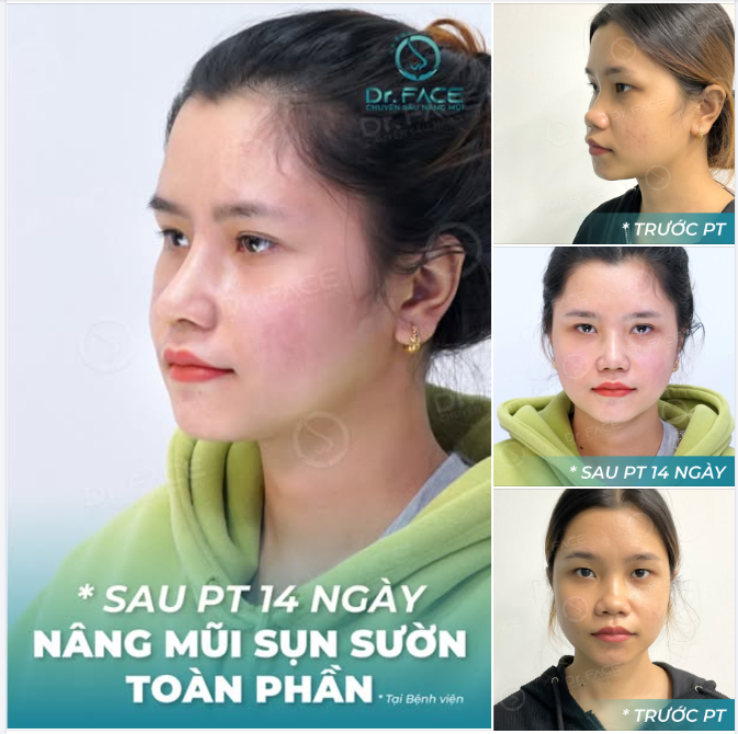 Hôm nay thời tiết có thể xấu  Nhưng em thì bắt buộc phải đẹp