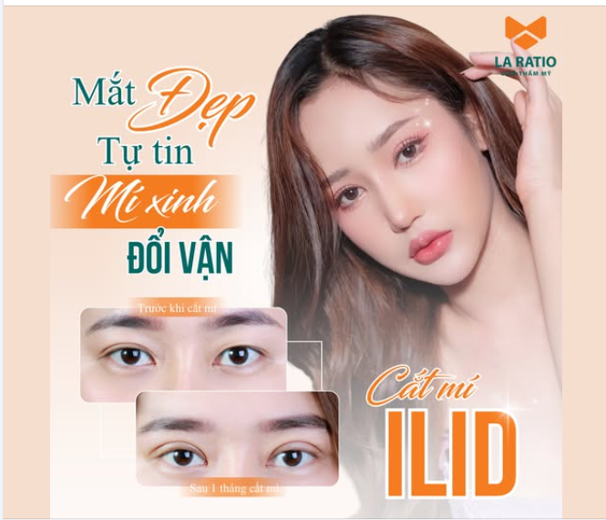 Khách feedback “Dịch vụ cắt mí ILID ở La Ratio xứng đáng 0 điểm….  0 điểm nào để chê hết”