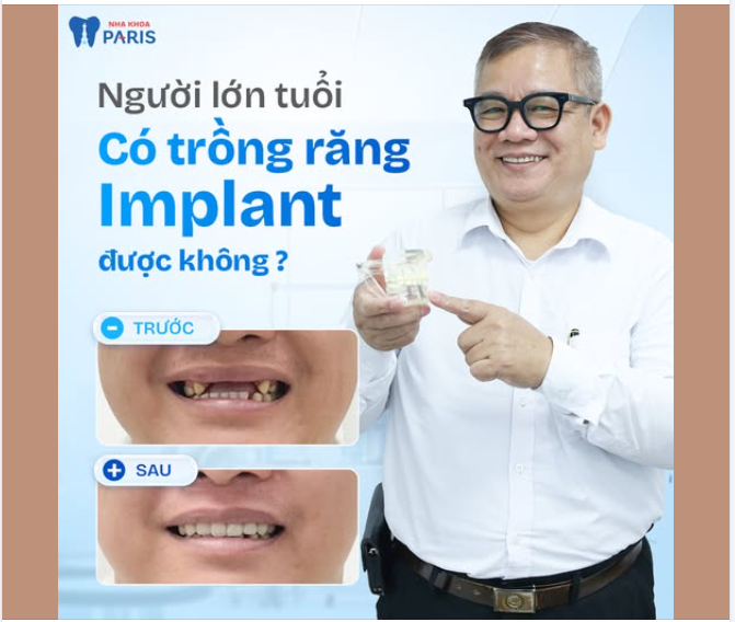Người lớn tuổi có trồng răng implant được không?   Chuyên gia giải đáp