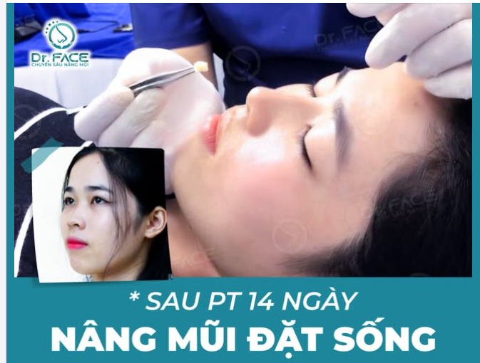 CHỤP VỘI CŨNG KHÔNG CHE NỔI VẺ ĐẸP CHIẾC MŨI