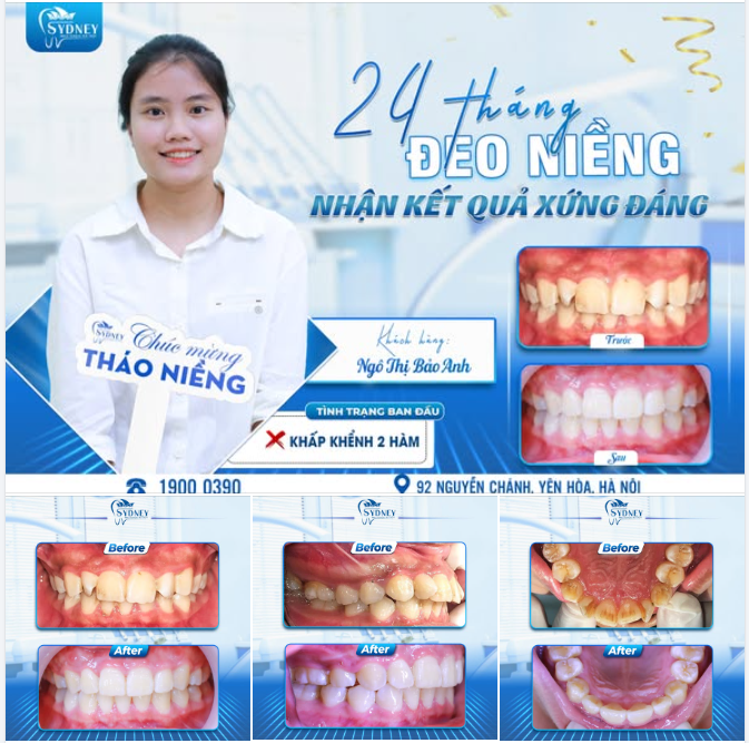 24 THÁNG ĐEO NIỀNG NHẬN VỀ KẾT QUẢ XỨNG ĐÁNG