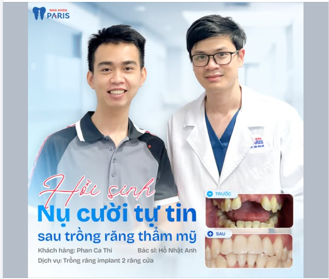 Hồi sinh nụ cười tự tin sau trồng răng thẩm mỹ