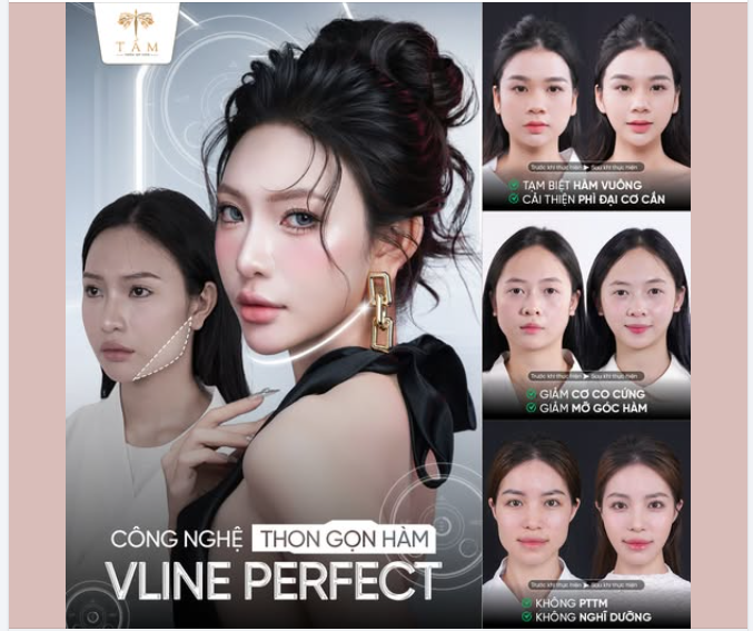 VLINE PERFECT - BƯỚC TIẾN VƯỢT BẬC LÀM THON GỌN HÀM BẰNG CÔNG NGHỆ CAO