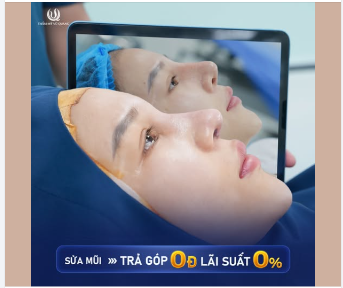 60 phút thay đổi dáng mũi – Đẹp chuẩn tỉ lệ vàng!