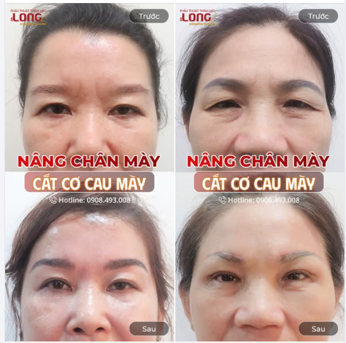 GƯƠNG MẶT VUI VẺ KHÔNG CÒN “KHÓ Ở”