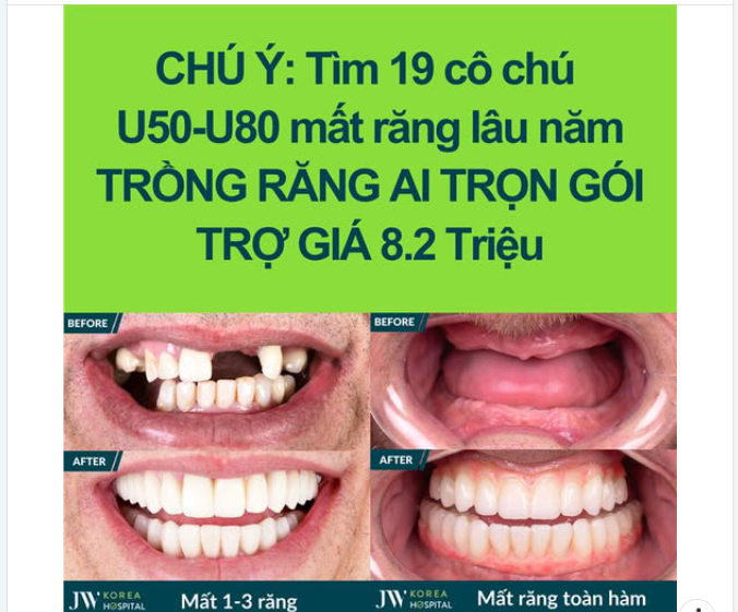 TÌM GẤP 19 CÔ CHÚ U50 - U80 MẤT RĂNG TẶNG VÉ MIỄN PHÍ 30% TRỒNG RĂNG IMPLANT - ĂN NGON, CƯỜI ĐẸP