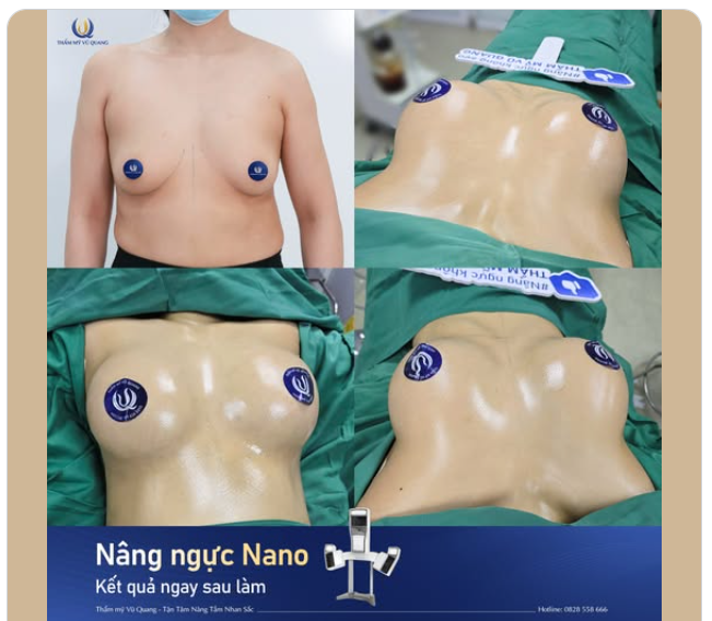 Làm mẹ không có nghĩa là bỏ quên bản thân  Sau sinh, hãy cho mình quyền đẹp lại, rực rỡ hơn và yêu bản thân mình nhé các chị em