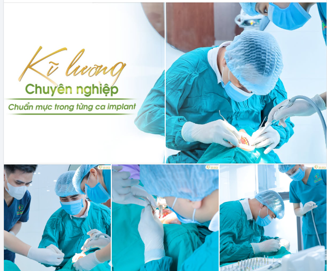 Trồng Implant - An tâm tuyệt đối cùng đội ngũ chuyên gia VIET SMILE