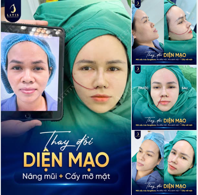 THAY ĐỔI NGOẠN MỤC VỚI COMBO MŨI  MẶT