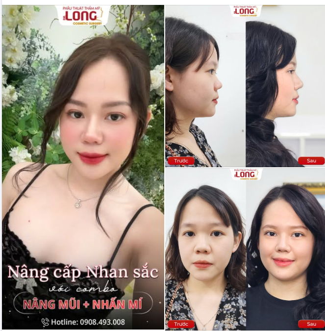 9/9 – Ngày của sự đổi thay, bạn đã sẵn sàng chưa?