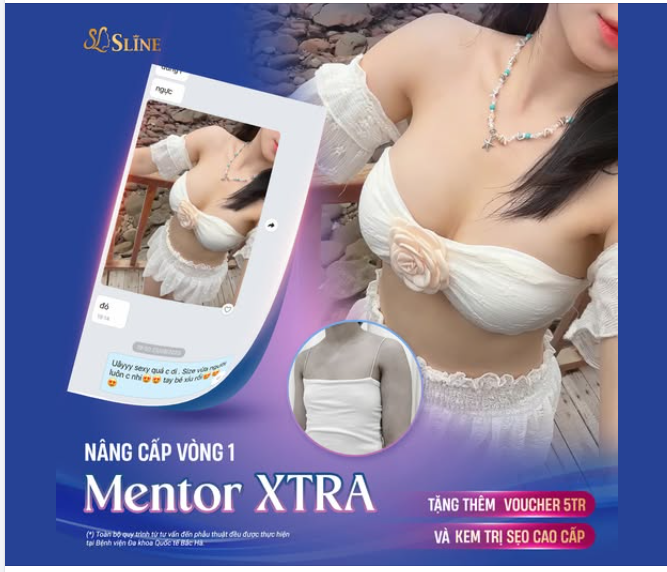 MENTOR XTRA – LỰA CHỌN NÂNG CẤP VÒNG 1 TINH TẾ.