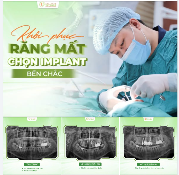 70 TUỔI TRỒNG IMPLANT ĐƯỢC KHÔNG