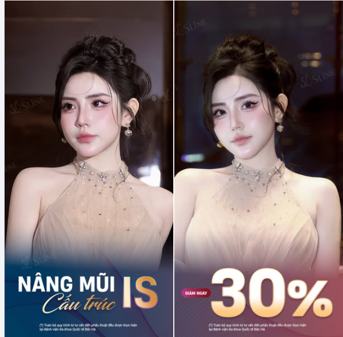 NÂNG MŨI IS CẤU TRÚC – TÁI ĐỊNH HÌNH VẺ ĐẸP THANH TÚ.