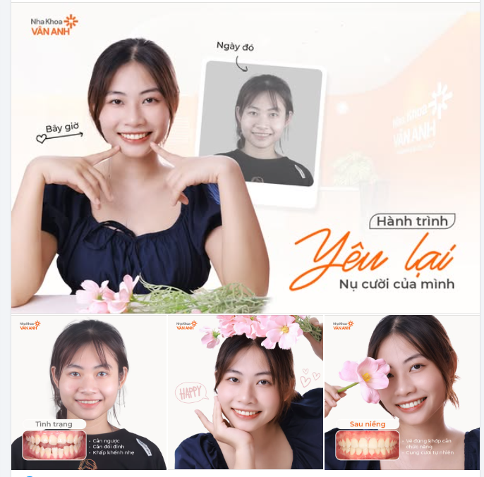 Hành trình yêu lại nụ cười của mình