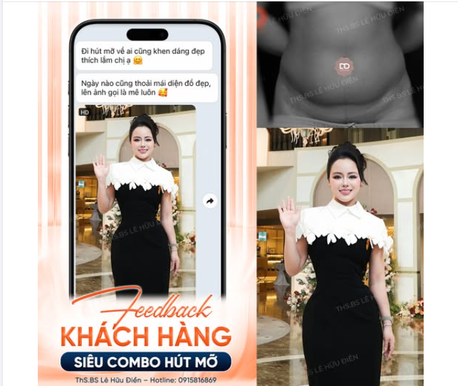BIẾN HÌNH NGOẠN MỤC VỚI SIÊU COMBO HÚT MỠ: BỤNG + HÔNG + CÁNH TAY + VAI NÁCH + LƯNG