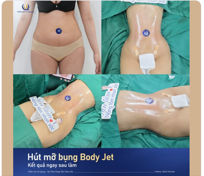 Chỉ cần bạn cảm thấy chưa hài lòng với một khuyết điểm nào đó trên cơ thể, thì Dr. Vũ Quang luôn sẵn sàng đồng hành để bạn tỏa sáng và tự tin hơn mỗi ngày!