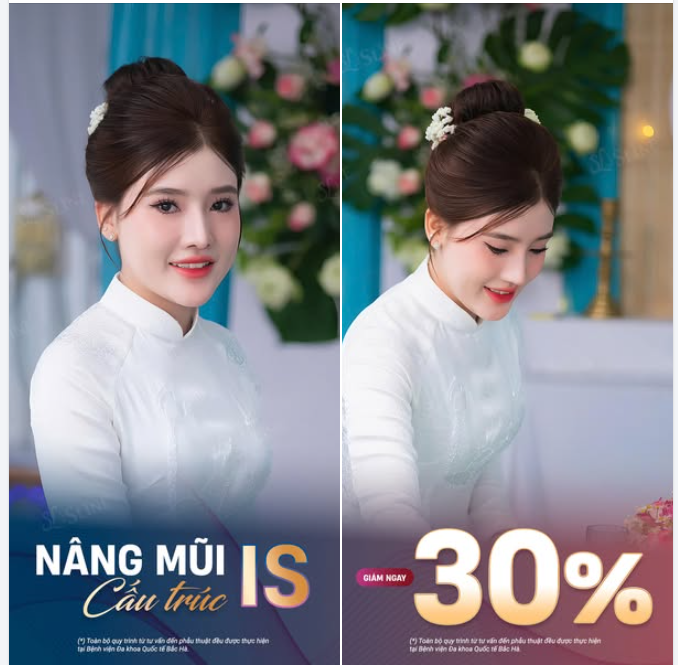 NÂNG MŨI CẤU TRÚC IS – TINH TẾ THANH LỊCH.