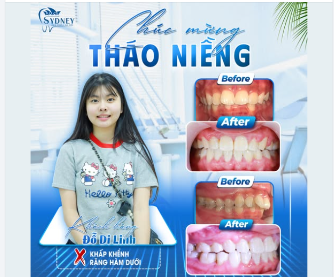 CHÚC MỪNG THÁO NIỀNG KH.DI LINH