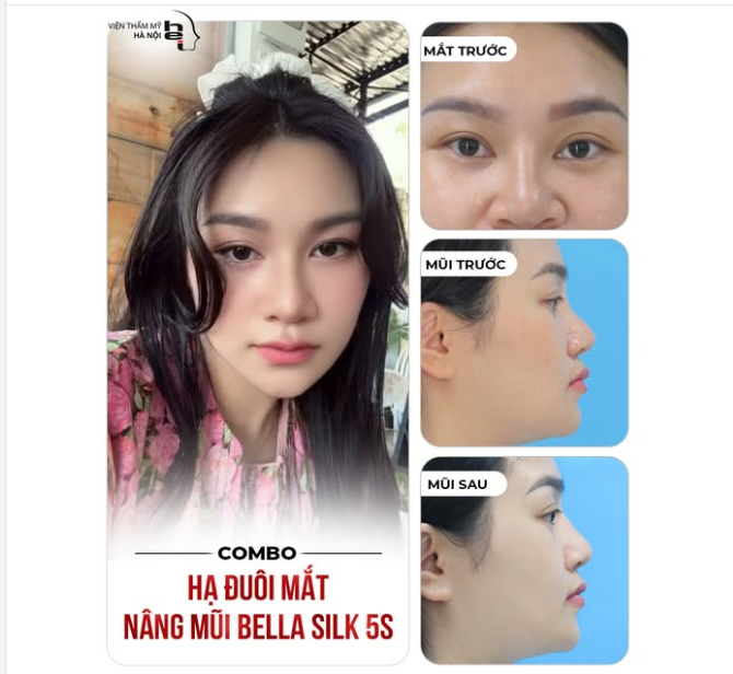 Nhan sắc chạm đỉnh chỉ cần nhấn nhá vài nét trên gương mặt  Feedback đỉnh nóc đến từ khách hàng GenZ 
