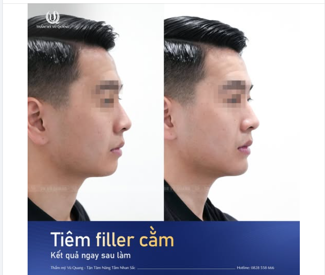 Ai bảo đàn ông thì không cần làm đẹp nhỉ?