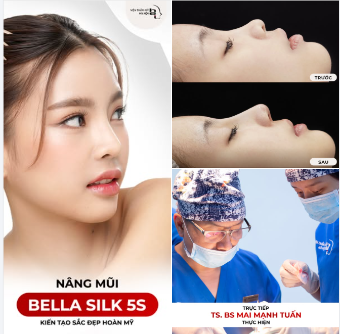 NÂNG MŨI BELLA SILK 5S   Dáng mũi thanh tú - Kiến tạo sắc đẹp hoàn mỹ 