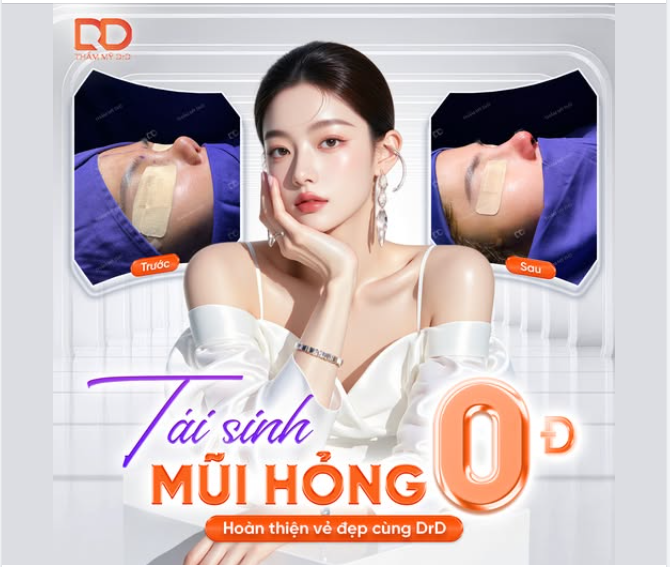 TÁI SINH MŨI 0Đ – HOÀN THIỆN VẺ ĐẸP CÙNG DRD