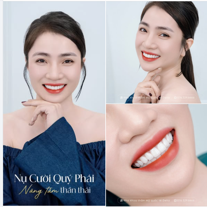 Một nụ cười đẹp không chỉ dừng lại ở vẻ ngoài – đó còn là “chìa khóa vàng” nâng tầm thần thái và khẳng định phong cách riêng.