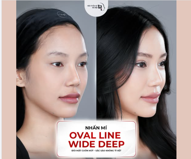 NHẤN MÍ OVAL LINE WIDE DEEP – MỞ KHÓA THẦN THÁI CHỈ SAU 30 PHÚT