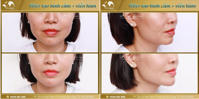 Hãy cùng Thế Giới Đẹp nhìn lại sự thay đổi của Cô nàng qua những hình ảnh sau đây nhé!