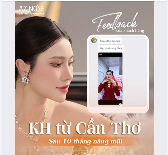 Ngại hết cả AZ NOSE  Dáng mũi thực hiện bởi Bác sĩ Hoàng Nam!