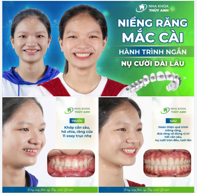 HÀNH TRÌNH MẮC CÀI: ĐỔI VÀI NĂM - CƯỜI ĐẸP CẢ ĐỜI