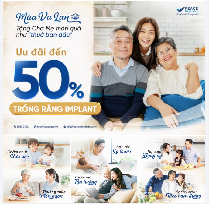 ƯU ĐÃI ĐẾN 50% TRỒNG RĂNG IMPLANT