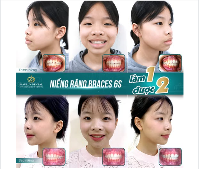 “Có những thay đổi không chỉ nằm ở hàm răng, mà còn ở ánh mắt, thần thái, cả cách một người tự tin bước đi.