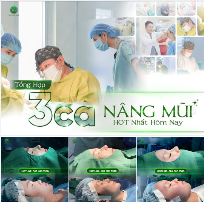Tổng hợp 3 ca nâng mũi hot nhất hôm nay