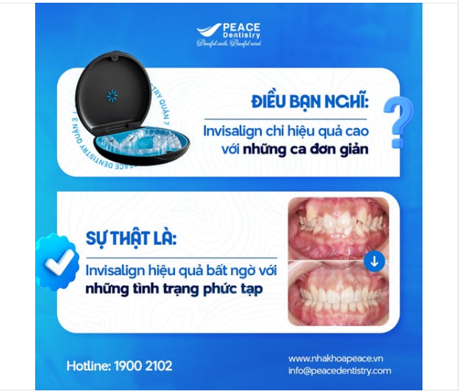 TRÊN 90% ĐỀU MẮC PHẢI SAI LẦM KHI NGHĨ RẰNG INVISALIGN CHỈ HIỆU QUẢ VỚI TÌNH TRẠNG RĂNG LỆCH NHẸ