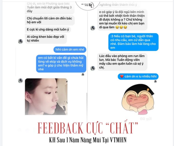 LẠI LÀ FEEDBACK KH SAU 1 NĂM NÂNG MŨI NHÀ BÁC SĨ