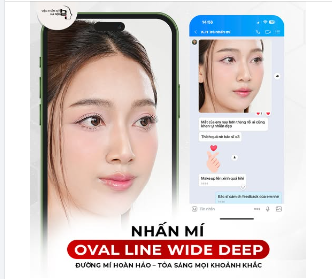Nhấn mí Oval Line Wide Deep - ĐẸP TỪNG CENTIMET