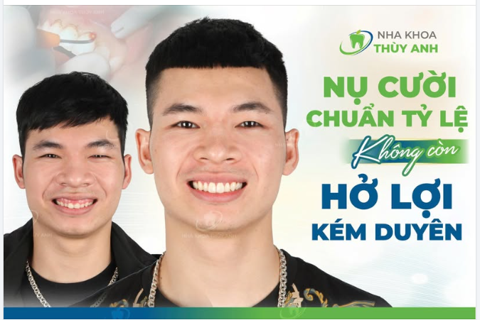 CÂN LẠI TỈ LỆ NỤ CƯỜI, TỰ TIN RẠNG NGỜI