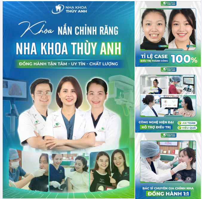 Khoa nắn chỉnh răng nha khoa Thùy Anh - Chúng tôi hiểu rằng niềng răng không chỉ là mang tới cho khách hàng nụ cười đẹp…