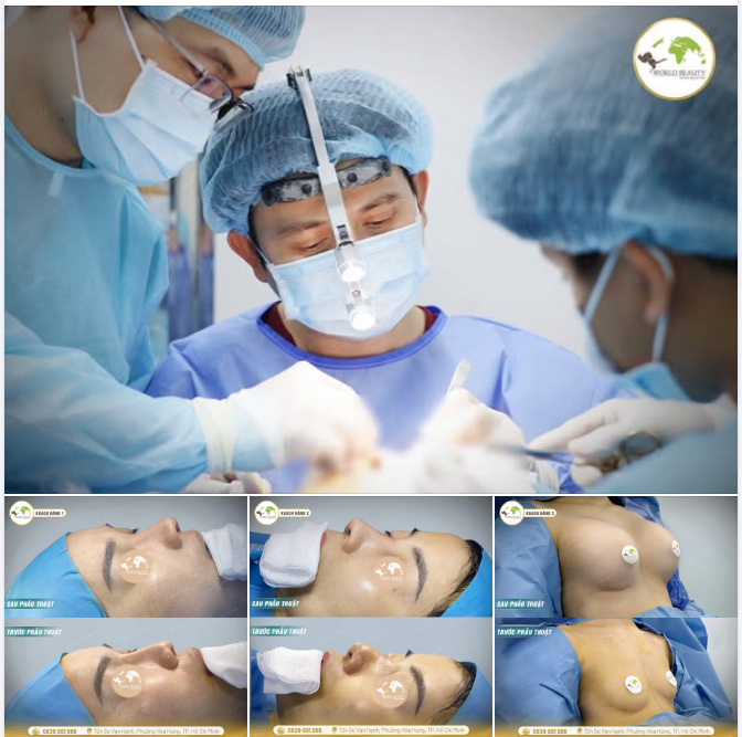 Những hình ảnh dưới đây là 3 ca phẫu thuật đã được hoàn thành tại Thế Giới Đẹp