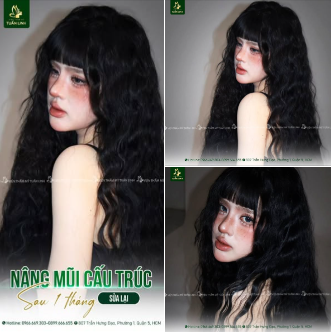 Chọn đúng địa chỉ thẩm mỹ, bạn mới chạm đến phiên bản rực rỡ nhất của mình