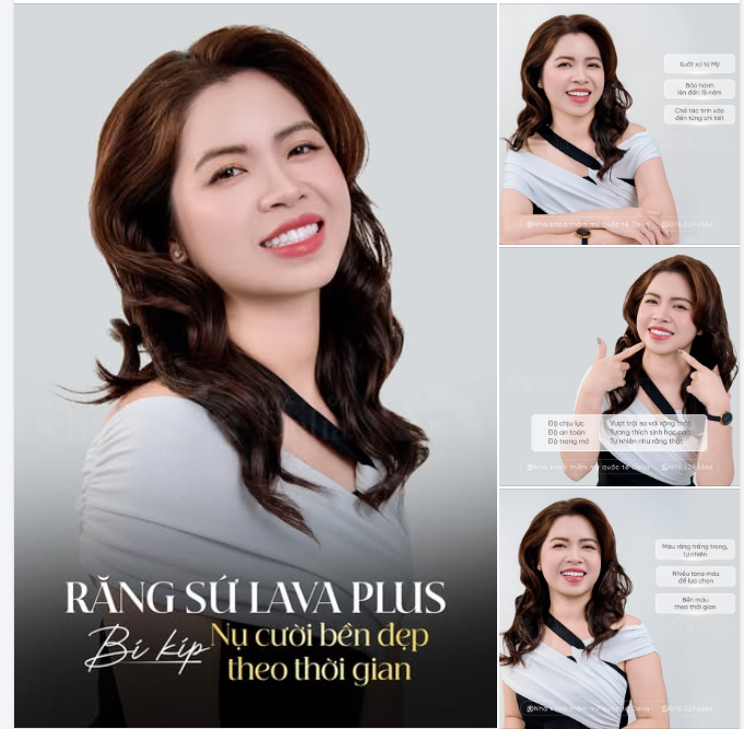 Răng sứ Lava Plus – Bí kíp để nụ cười luôn bền đẹp cùng thời gian