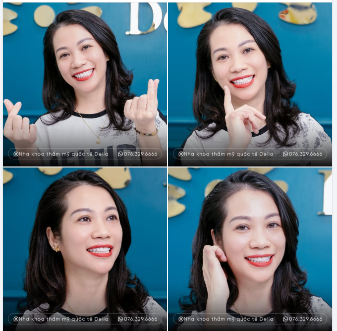 Có những khoảnh khắc thật sự khiến Delia vô cùng biết ơn và hạnh phúc – đó là khi nhìn thấy khách hàng mỉm cười rạng rỡ sau khi tìm thấy được nụ cười tỏa sáng.
