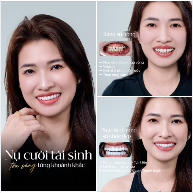 “TÁI SINH” NỤ CƯỜI – NHAN SẮC THĂNG HOA